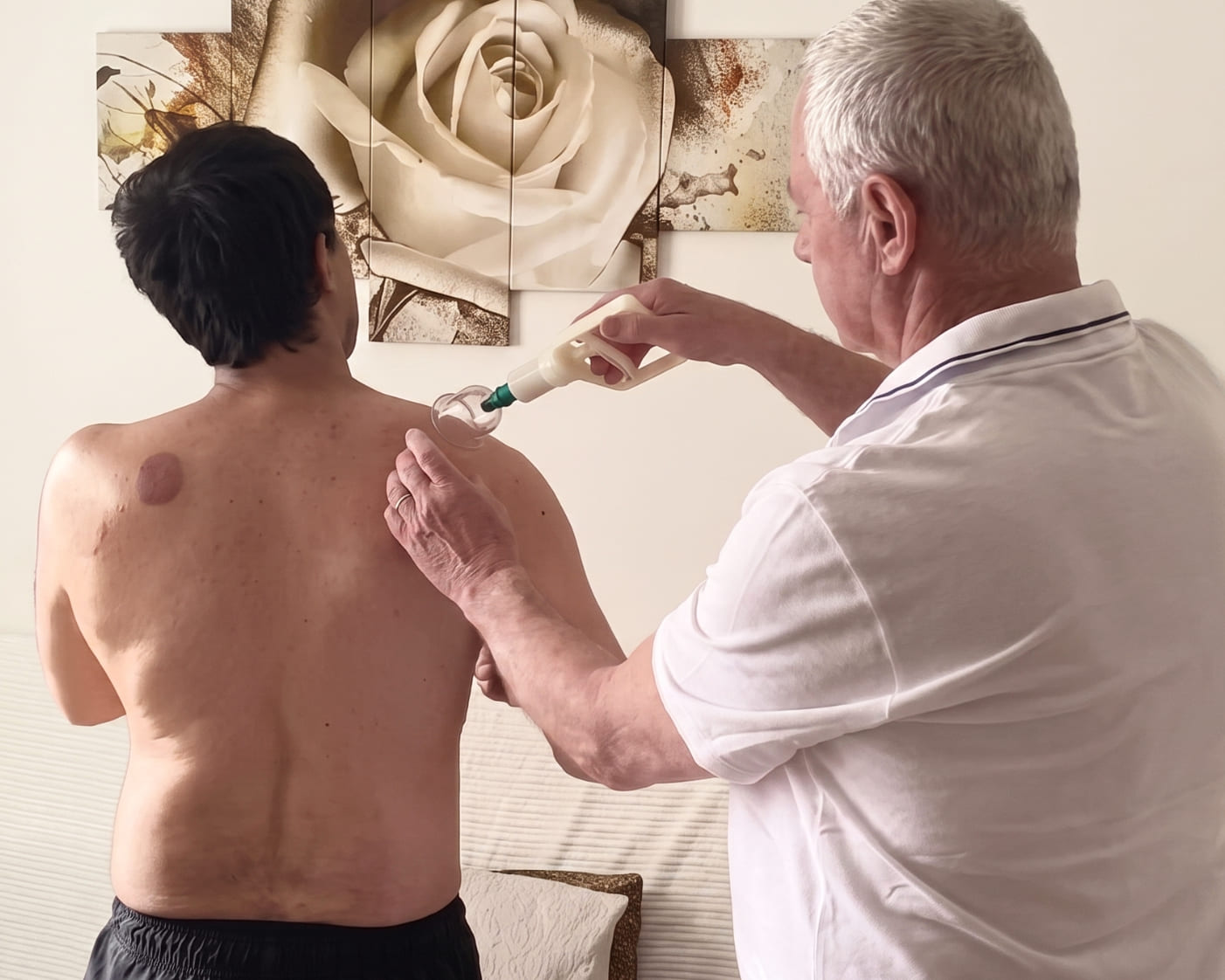 Köpölyözés | Nyugalom Kapuja